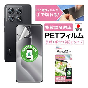 �y����+�M�����h�~�E�A���`�O���A�zXiaomi 14T Pro �ی�ی�t�B���� �w��F�ؑΉ� �}�b�g ���炳�� �m���O���A�t���ی�t�B����SE �h�w�� ���˖h�~ �C�A���� ���ʕی� ���ʕی�t�B���� �t�B