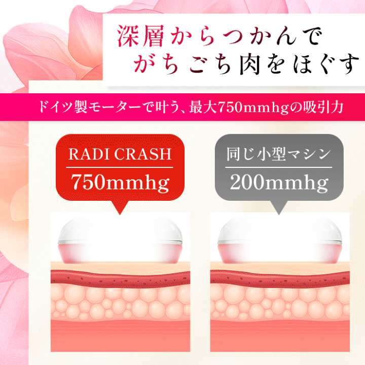【超美品】ラジクラッシュ 吸引 ラジオ波 エステ機器 RADI CRASH RADI CRUSH|1MHzマルチポーラ式ラジオ波と強力吸引で圧倒的