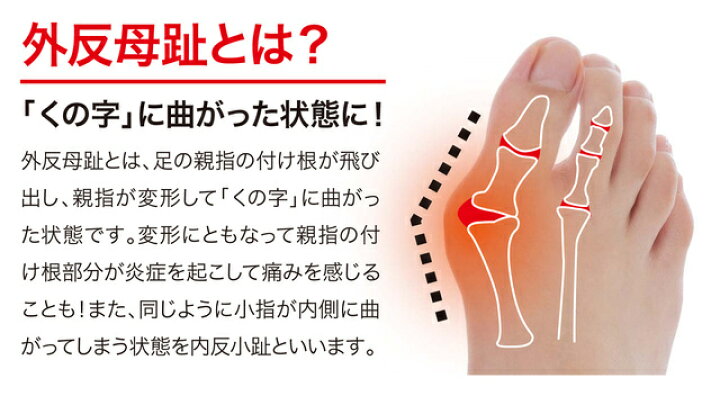 楽天市場 外反母趾 内反小趾 サポーター 足指 広げる 外反母趾サポーター 内反小趾サポーター 矯正 外反母指 外反拇指 矯正グッズ 矯正サポーター 浮き指 小指 ストレッチ Makuake モアコム 外反母趾おやすみサポーター お買い物マラソン 送料無料 ポイント消化