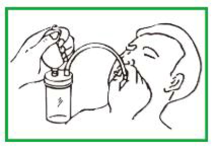 楽天市場】手動式吸引器 鼻水吸引 ブルークロス ハンドバルブアスピレーター (手動式吸引器) HA-210【手動吸引器】【介護用品】【鼻水吸引】【痰吸引】  : もりもり健康堂楽天市場店