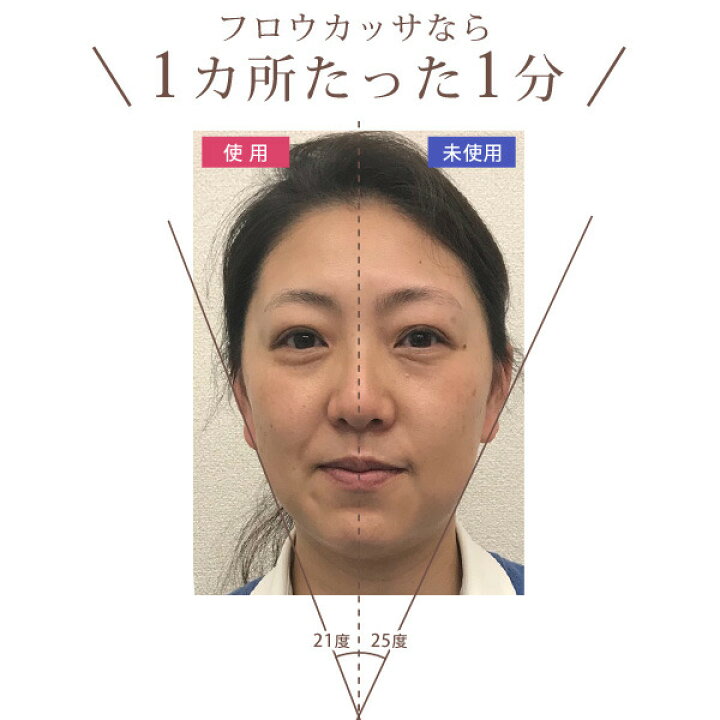 楽天市場 Ems 進化系かっさ 美顔器 フロウカッサ Flow Kassa かっさ 美顔機 美顔 リフトアップ 顔 エビス化粧品 美顔器 原液ならモテビューティー