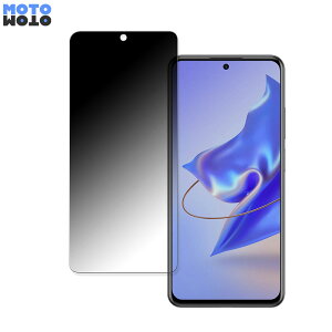 �y�|�C���g2�{�z ZTE Voyage 30 Pro+ ������ 180�x �`�����h�~ �t�B���� �u���[���C�g�J�b�g �A���`�O���A ���˖h�~ ���{��