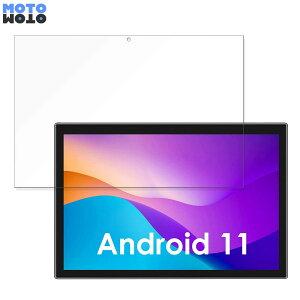 یtB LNMBBS M101  u[CgJbg tB dl {