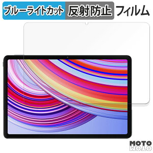 �ی�t�B���� Xiaomi Redmi Pad Pro 5G ������ �u���[���C�g�J�b�g �t�B���� �A���`�O���A ���{��