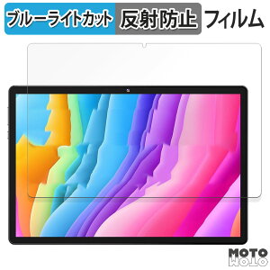 یtB MARVUE Pad M13  u[CgJbg tB A`OA {