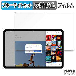 یtB Xiaomi Redmi Pad Pro  u[CgJbg tB A`OA {