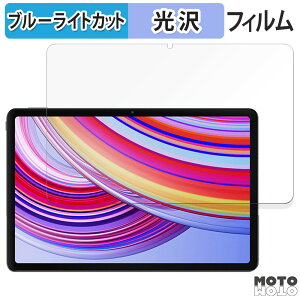 یtB Xiaomi Redmi Pad Pro 5G  u[CgJbg tB dl {