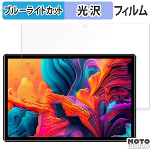 �y�|�C���g2�{�z �ی�t�B���� DOOGEE U9 ������ �u���[���C�g�J�b�g �t�B���� ����d�l ���{��