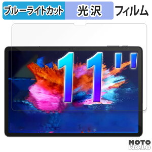 یtB AvidPad S80  u[CgJbg tB dl {