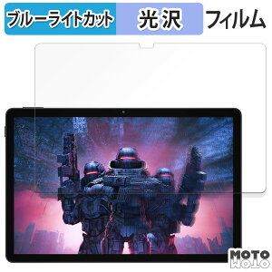 یtB DOOGEE U11  u[CgJbg tB dl {