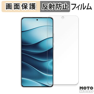 یtB Xiaomi Redmi Note 14 5G  tی tB A`OA {