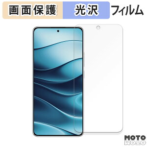 یtB Xiaomi Redmi Note 14 5G  tی tB dl {