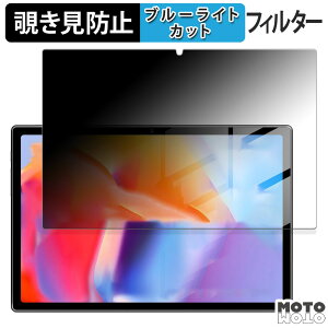 180�x �̂������h�~ �t�B���� Tuotatop x13-2 ������ �u���[���C�g�J�b�g �A���`�O���A ���{��