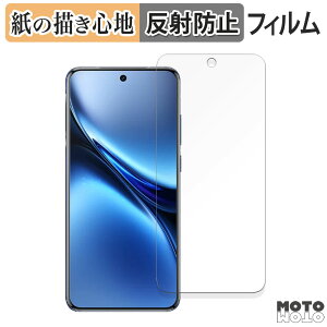 y[p[CN tB vivo X200  tیtB ̂悤ȏSn A`OA {