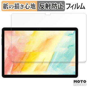 y[p[CN tB ALLDOCUBE iPlay 60S / iPlay 60S 4G (  )  tB ̂悤ȏSn {