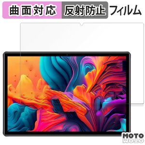 �y�|�C���g2�{�z �ی�t�B���� DOOGEE U9 ������ �t�B���� �ȖʑΉ� �A���`�O���A ���{��