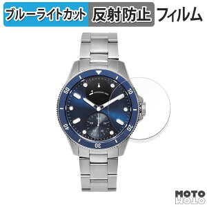 یtB Withings ScanWatch Healthmaster 42mm  u[CgJbg tB ȖʑΉ A`OA {