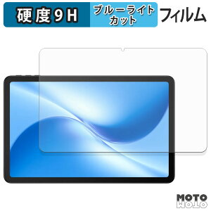 یtB DOOGEE U12 u[CgJbg tB 9Hdx A`OA {