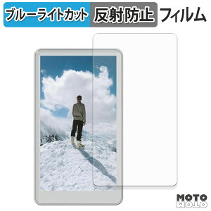 یtB JEVDES B胂j^[ ZPXSQ-1000 u[CgJbg tB A`OA {