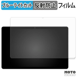 یtB Rebecco M30Pro u[CgJbg tB A`OA {