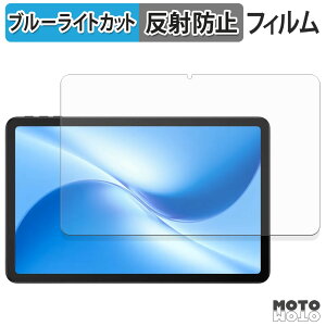 یtB DOOGEE U12 u[CgJbg tB A`OA {