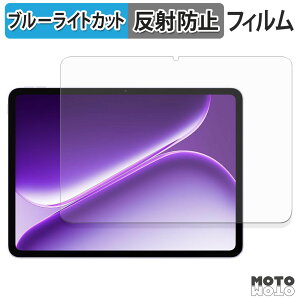�ی�t�B���� OnePlus Pad Go 2 �O���[�o���� �u���[���C�g�J�b�g �t�B���� �A���`�O���A ���{��