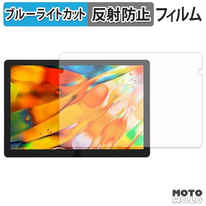 �y8/27 9:59�� �|�C���g2�{�z �ی�t�B���� XP-Pen Artist Ultra 14 �u���[���C�g�J�b�g �t�B���� �A���`�O���A ���{��