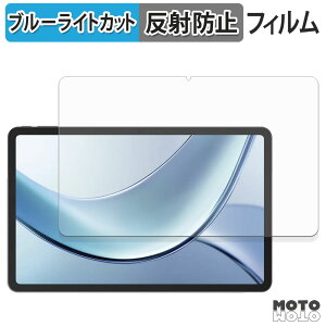 یtB DOOGEE Vpad u[CgJbg tB A`OA {