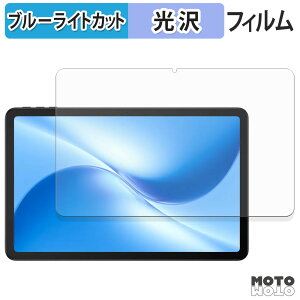 یtB DOOGEE U12 u[CgJbg tB dl {