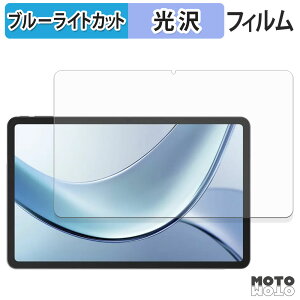 یtB DOOGEE Vpad u[CgJbg tB dl {