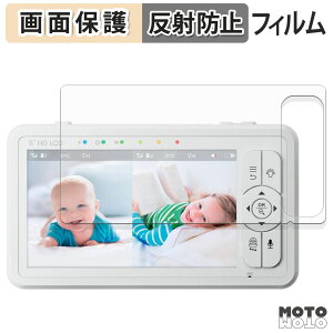 �y�|�C���g2�{�z �ی�t�B���� babysense ���ǂ������J���������掿�x�r�[���j�^�[ HDS2 �t���ی� �t�B���� �A���`�O���A ���{��
