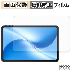 یtB DOOGEE U12 t یtB A`OA {