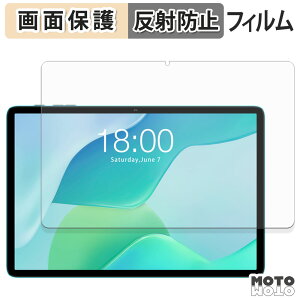 �ی�t�B���� Teclast P33 �t�� �ی�t�B���� �A���`�O���A ���{��