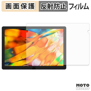 �y8/27 9:59�� �|�C���g2�{�z �ی�t�B���� XP-Pen Artist Ultra 14 �t�� �ی�t�B���� �A���`�O���A ���{��