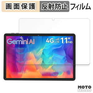 �y�|�C���g2�{�z �ی�t�B���� Tabwee W90 �t�� �ی�t�B���� �A���`�O���A ���{��