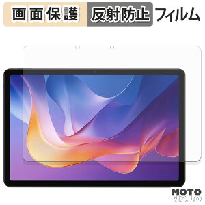 �ی�t�B���� Xiaomi Redmi Pad 2 4G �t�� �ی�t�B���� �A���`�O���A ���{��