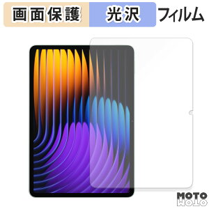 یtB Xiaomi Pad 7 / 7 Pro t یtB dl {