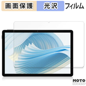 یtB DOOGEE U11 PRO t یtB dl {