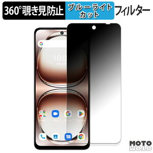 360x `h~ tB UMIDIGI Note 100A یtB u[CgJbg {