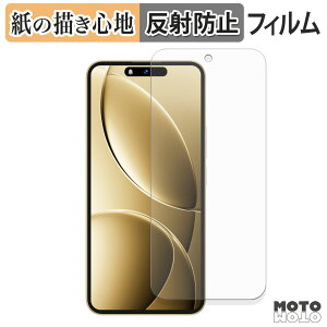 y[p[CN tB OUKITEL P1 Pro tیtB ̂悤ȏSn A`OA {