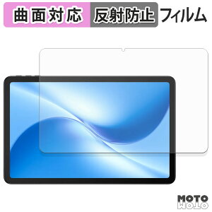 یtB DOOGEE U12 tB ȖʑΉ A`OA {