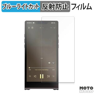 یtB ONIX Waltz XM10 LTD u[CgJbg tB ȖʑΉ A`OA {