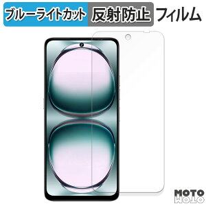 یtB UMIDIGI Note 100 u[CgJbg tB ȖʑΉ A`OA {
