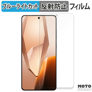 یtB OnePlus 13R u[CgJbg tB ȖʑΉ A`OA {