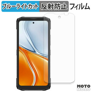 �ی�t�B���� DOOGEE Blade20 Turbo �u���[���C�g�J�b�g �t�B���� �ȖʑΉ� �A���`�O���A ���{��
