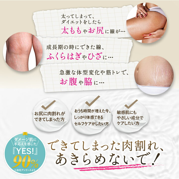 楽天市場 アフターケアセット 産後 加齢に クリーム1本 Vcオイル1本 スカルプエッセンス1本 スカルプブラシ無料プレゼント 肉割れ 妊娠線 クリーム ボディクリーム マッサージ ダイエット お尻 太もも お腹 アロマ 妊娠線クリーム 保湿 乾燥 Nocorノコア公式