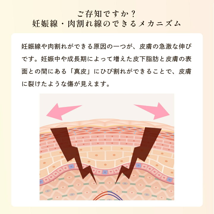 楽天市場】＼期間限定特別セール!／ 肉割れ クリーム [妊娠線対策 