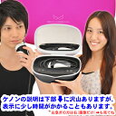 【ケノン 公式　楽天スーパーSALE！3年保証】（最新バージョン）脱毛器 ランキング587週1位※ 日本製 美顔器 家庭用 …
