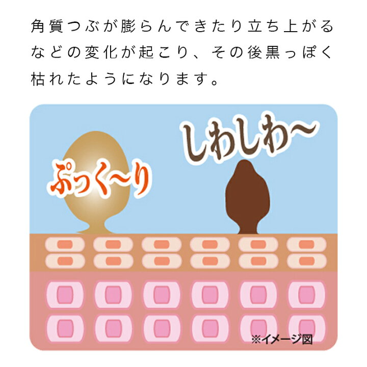 イボ取り 疣贅 クリーム 顔 首 角質ケア 凸凹 でこぼこ ジェル 扁平疣贅