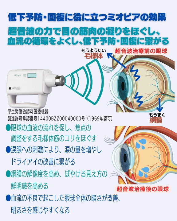 視力回復 超音波 （視力回復、眼精疲労改善にアイパワー（超音波治療器 